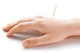 soins acupuncture geneve