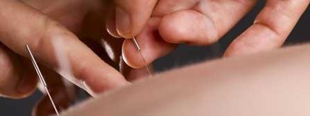 acupuncture geneve